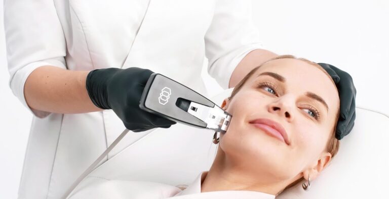 RF Microneedling
